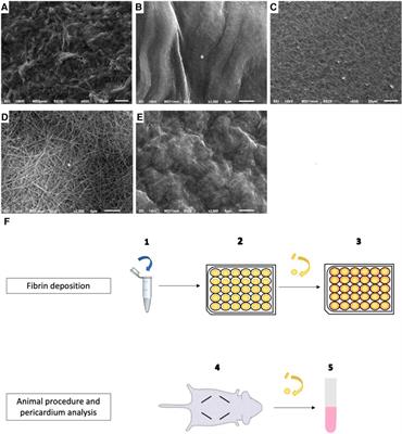 Fibrin deposition on bovine pericardium tissue used for bioprosthetic heart valve drives its calcification